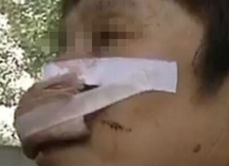 Il arrache le nez de sa femme et le mange